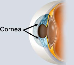 corneal disease 1.jpg